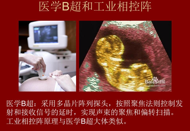 工業(yè)相控陣原理與醫(yī)學(xué)B超大體類似，醫(yī)學(xué)B超采用多晶片陣列探頭，按照聚焦法則控制發(fā)射和接收信號(hào)的延時(shí)，實(shí)現(xiàn)聲束的聚焦和偏轉(zhuǎn)掃描